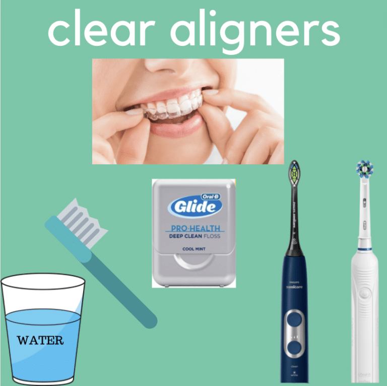How to Keep My Teeth Clean with Braces and Clear Aligners