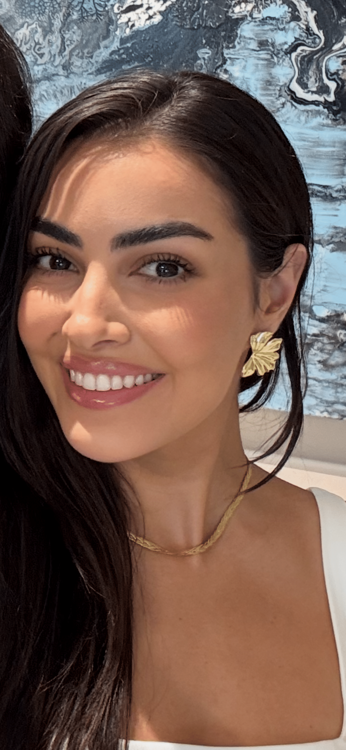 Adults with aligners escondido ca