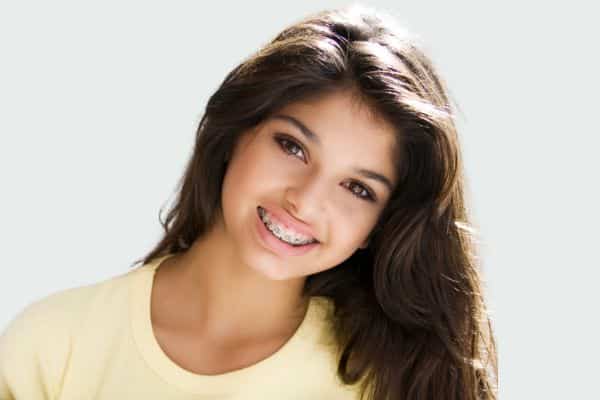 cost of braces escondido ca